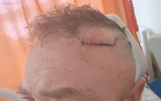 Sbírka pro mého manžela Dalibora s nádorem na mozku