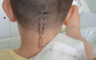 Sbírka pro našeho syna: Auto, které nám usnadní každodenní péči