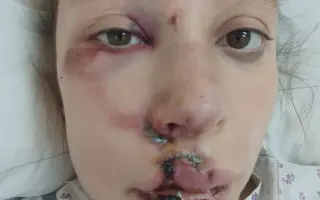 Pomozte mi vrátit úsměv po těžkém úrazu