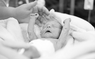 Neurorehabilitace pro předčasně narozené děti