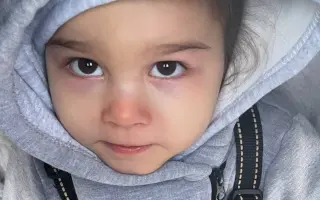 Pomoc pro Sašenku s dětskou mozkovou obrnou