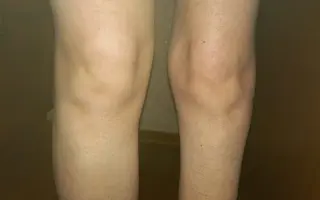 Aby měl Artur zase chodící mámu