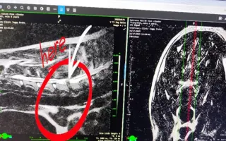 Canisterapeutický vlkodav Mlok Canisterapeutický vlkodav Mlok