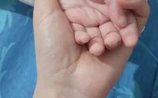 Rehabilitace a pomůcky pro Ardu