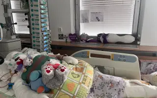 Šance pro Tondu na zotavení po vážných popáleninách