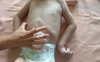 Dostal jsem druhou šanci. Teď se učím znovu žít.