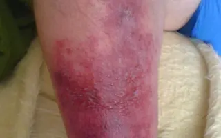 Elektrický vozík pro tátu, který chce zase žít naplno