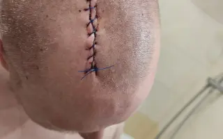 Naděje pro Honzu s rakovinou mozku – táta dvou kluků potřebuje naši pomoc