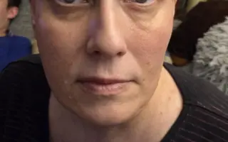 Pomoc pro Evičku bojující s rakovinou a její dceru