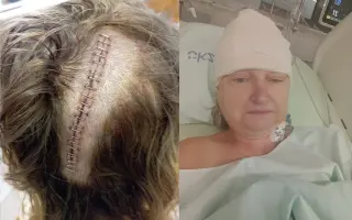 Sbírka na léčbu pro maminku Jáju s mozkovým nádorem