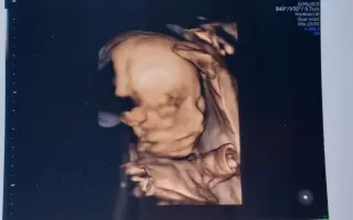 Pomoc pro těhotnou maminku samoživitelku v tíživé situaci