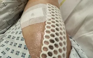 Zpátky k životu bez bolesti