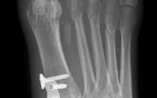 Naděje pro Karolinu (od Martina)