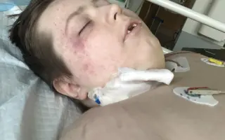 Za kouskem svobody pro malého bojovníka Macíčka