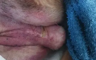 Pomozte Matýskovi zase běhat