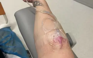 Pomoc pro mámu, které se rozpadají kosti a nechce se vzdát