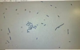 Pomoc Furině v boji s lupusem (SLE)