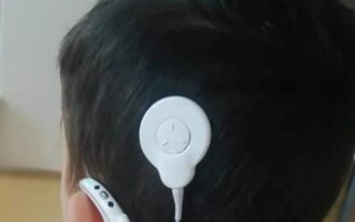 Baterie do cochlear pro neslyšícího Zdenečka