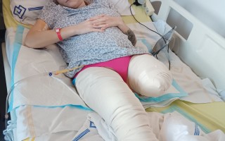 Dopravní nehoda mě připravila o nohu – pomozte mi s návratem do života