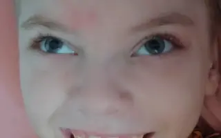 Pomozme bojovníkovi Michálkovi vykročit k prvnímu krůčku a lepší budoucnosti