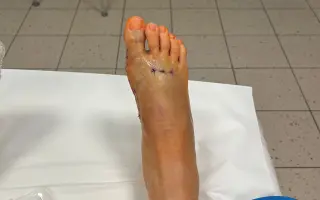 Naděje pro Karolinu (od Martina)