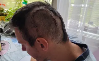 Můžete Petrovi zachránit život - You can save Peter's life