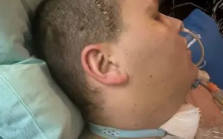 Pomozme začít po autonehodě opět žít