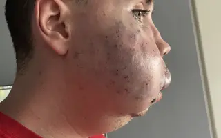 Pomozme Lukášovi zvládnout léčbu v zahraničí