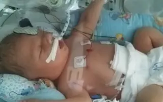 Ivánek se pere s těžkým osudem – pomozme mu společně