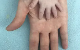 Pojďme dát Domískovi šanci chodit!