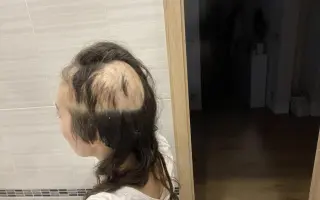 Pomozme Sáře v boji s rakovinou mozku