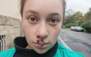 Pomozte mi vrátit úsměv po těžkém úrazu