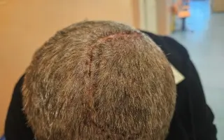 Pomozme Lence porazit nádor mozku