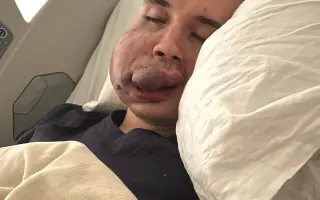 Pomozme Lukášovi zvládnout léčbu v zahraničí