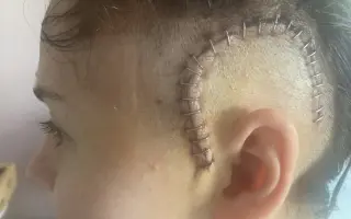 Pomozte Šarlotě v boji s nádorem mozku
