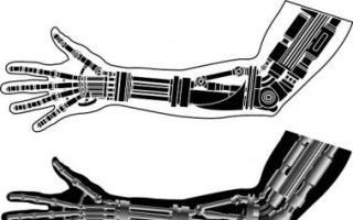 Nová bionická ruka pro Ladika 🦾