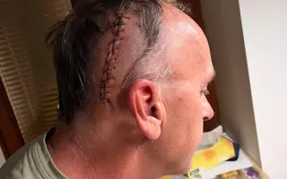 Pomozme Jiřímu v boji s agresivním nádorem mozku