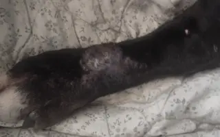 Pomohli jste Blackovi v boji s agresivním melanomem