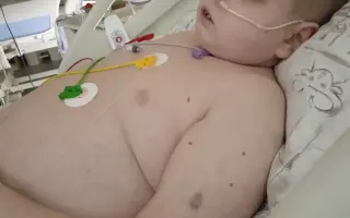 Za kouskem svobody pro malého bojovníka Macíčka
