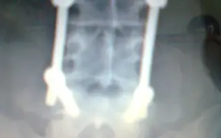 Elektrický pohon k vozíku pro Evu s DMO