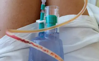 Pomozme Ivě po boji s rakovinou postarat se o dceru