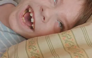 Pomozme bojovníkovi Michálkovi vykročit k prvnímu krůčku a lepší budoucnosti