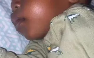 ❤️🙏 Pomoc pro malou Ayram z Ugandy s onemocněním plicní atrézie VSD