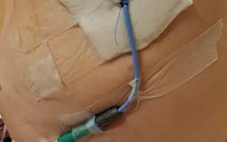 Pomoc při záchraně života před smrtí