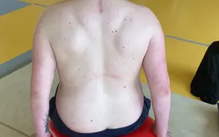 Skok, který změnil vše: Sbírka na léčbu kmenovými buňkami pro Pavla