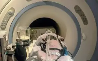 POMOC PRO FOXÍČKA, ASPENA A TAFFY-JACKA