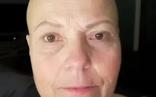 Vraťme úsměv: paruky na míru pro Kateřinu, Sandru a Lucii