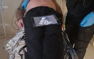 Zdravotnické batohy, naděje na život