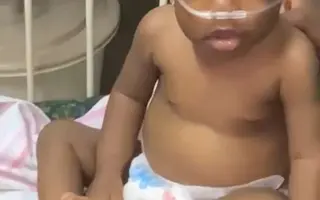 ❤️🙏 Pomoc pro malou Ayram z Ugandy s onemocněním plicní atrézie VSD