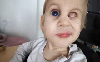 Tobiáškovi pro lepší život s Loweho syndromem